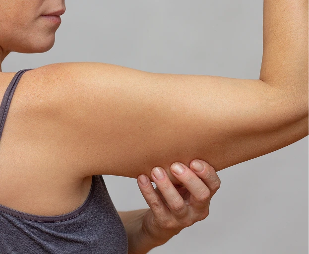What Is Arm Liposuction? Banner